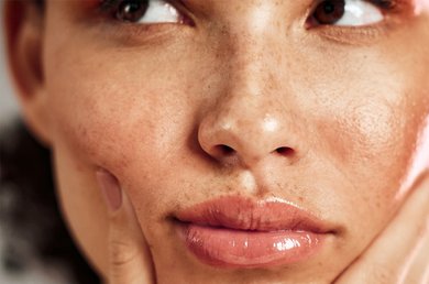 PIGMENTATION