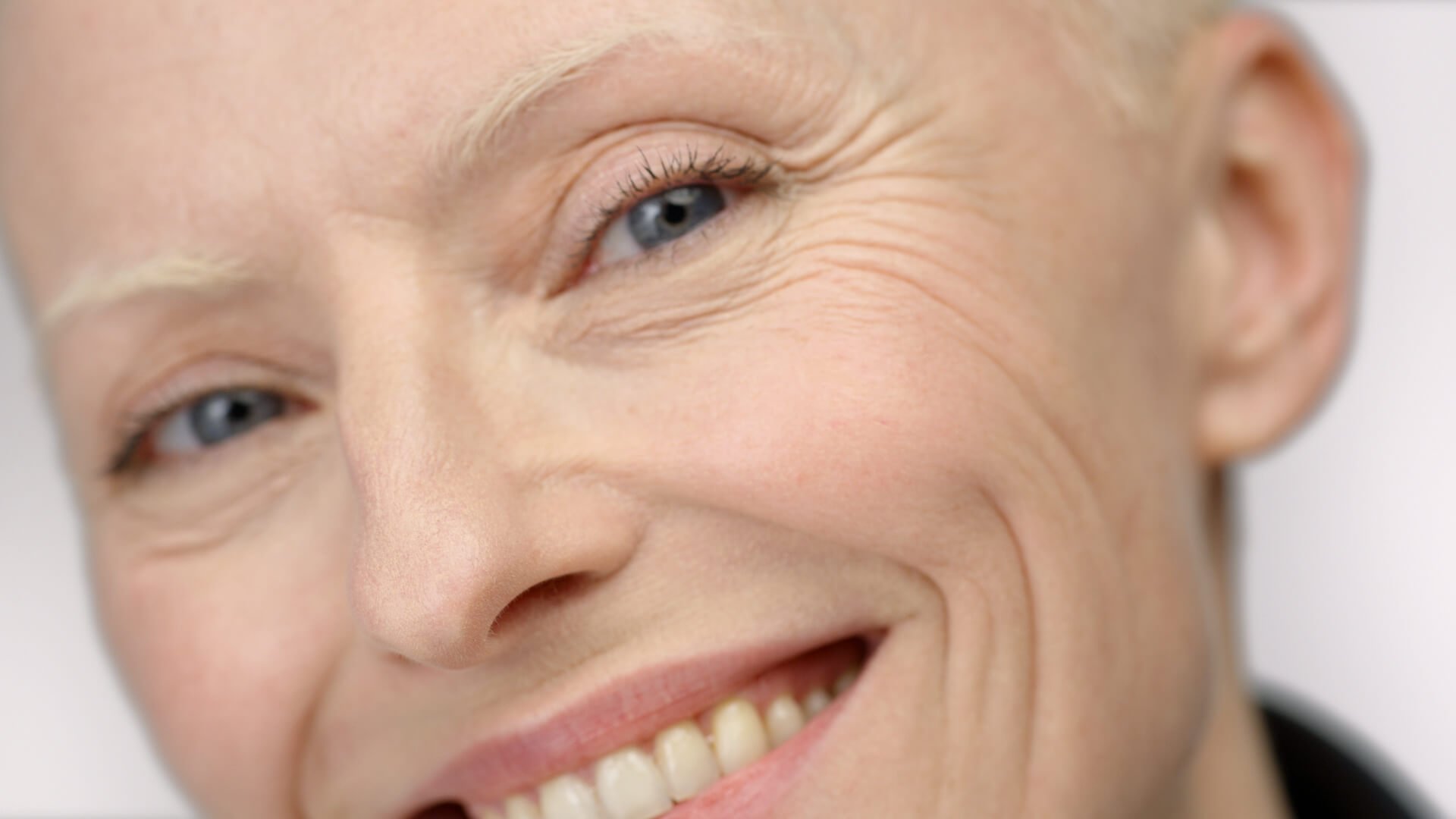 ja-luftföroreningar-gör-att-din-hud-åldras-och-här-är-varför